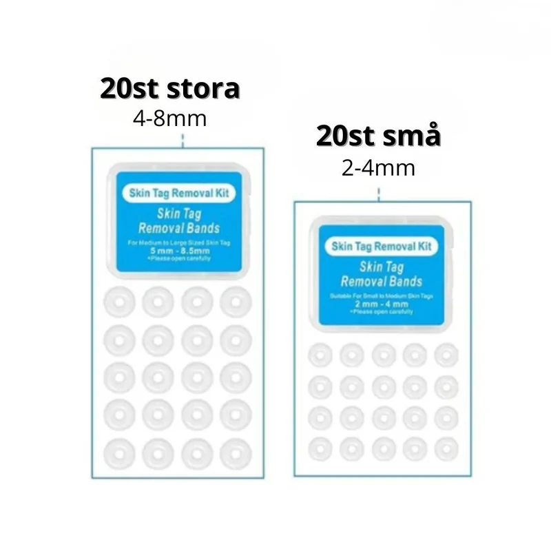 Refill för Leverfläcksborttagningen – 40 Extra Ringar